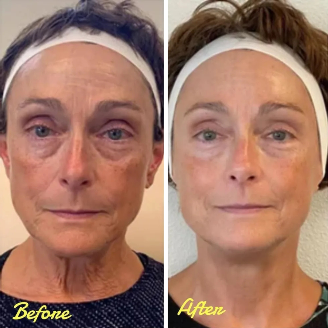 Reveal Your Glow: StellarGlow's Face Tightening Serum